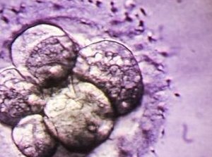 在盐城市妇幼保健院做试管婴儿要多少钱？成功率怎么样？附试管怀孕机构名单一览